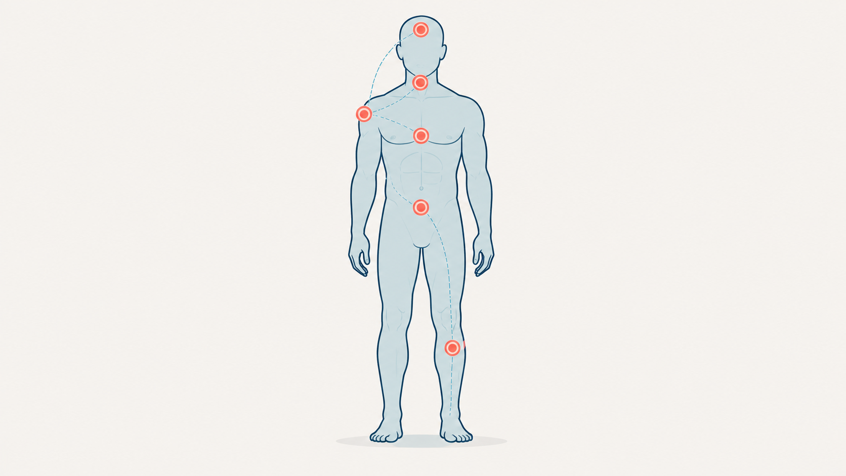 Body map illustration showing common areas of crash injury