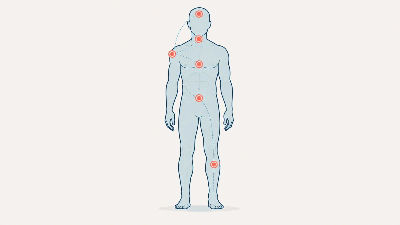 Body map illustration showing common areas of crash injury