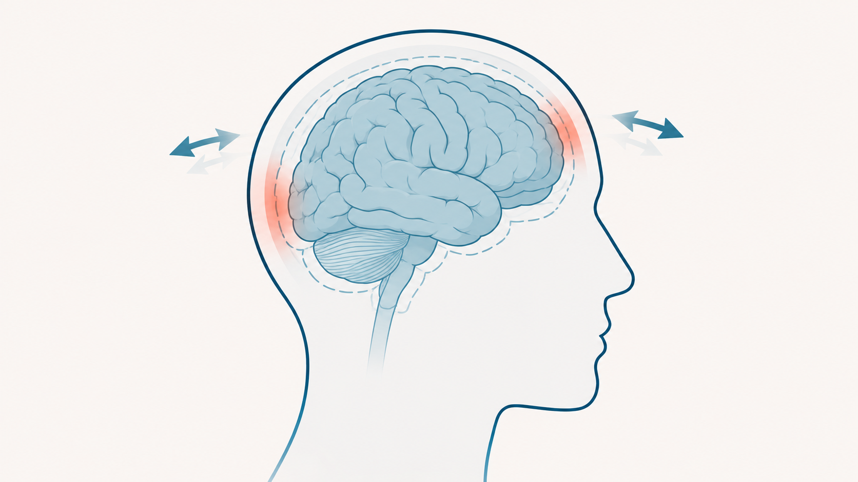 Illustration of the brain inside the skull showing concussion motion