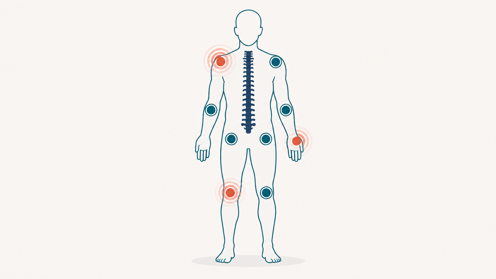 Illustration of a stylized human figure with major joints highlighted, showing the multi-location nature of joint and posture strain