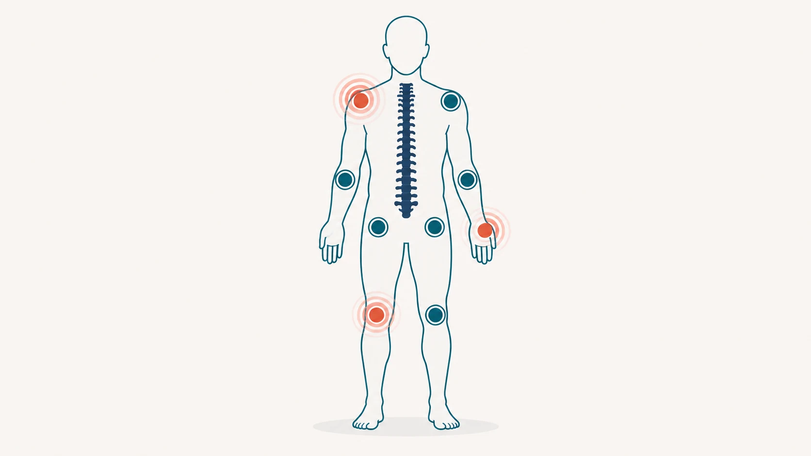 Illustration of a stylized human figure with major joints highlighted, showing the multi-location nature of joint and posture strain
