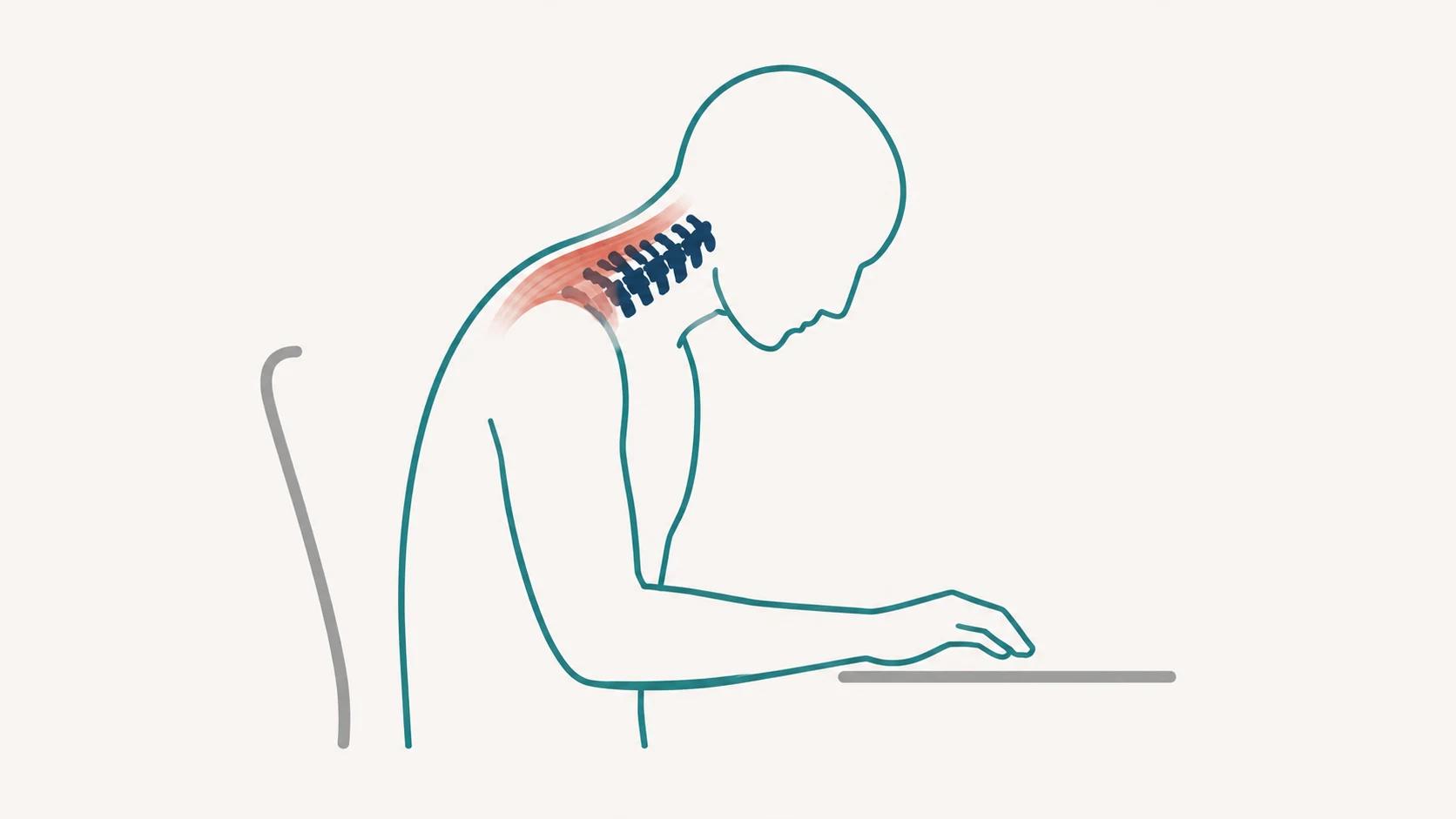 Illustration of a stylized human figure seated at a desk in a forward-hunched posture with strain at the back of the neck and upper shoulders